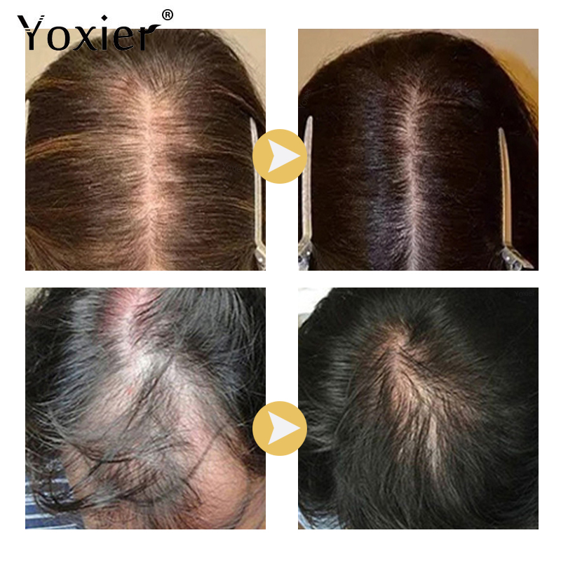 Sérum à croissance Intensive p - Hair Care Serum avis et prix